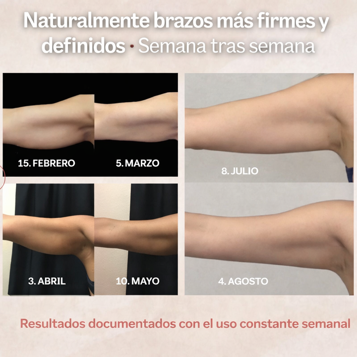 Mangas moldeadoras – adiós a los brazos flácidos-Curvella™